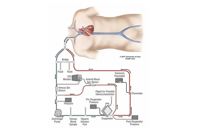 Dr MadhanS ECMO Health Care in Chennai - Chennai Ads