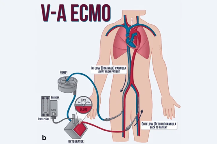 Dr MadhanS ECMO Health Care in Chennai - Chennai Ads