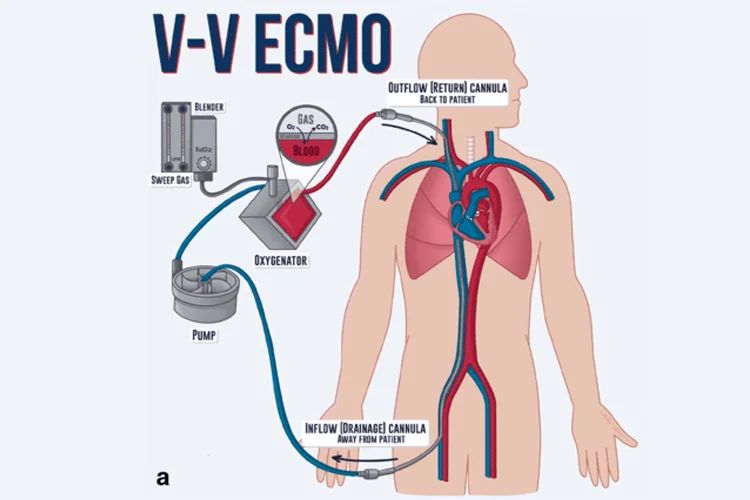 Dr MadhanS ECMO Health Care in Chennai - Chennai Ads