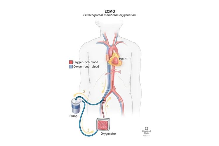 Dr MadhanS ECMO Health Care in Chennai - Chennai Ads